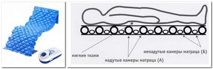 Как почистить фильтр компрессора противопролежневого матраса